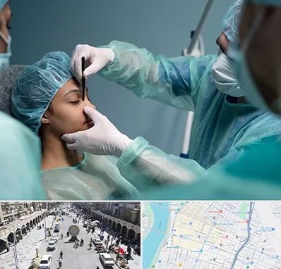 عمل بینی ارزان در نادری اهواز 