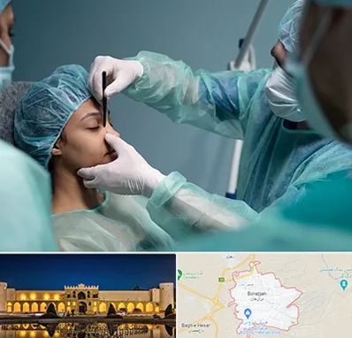 عمل بینی ارزان در برازجان