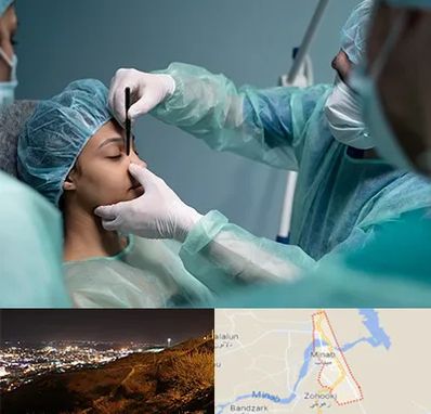 عمل بینی ارزان در میناب