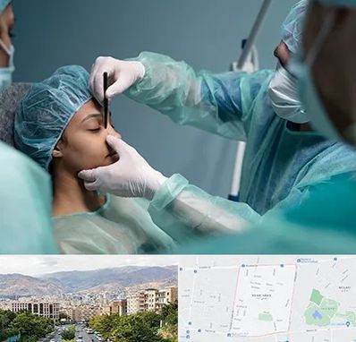 عمل بینی ارزان در خانی آباد 