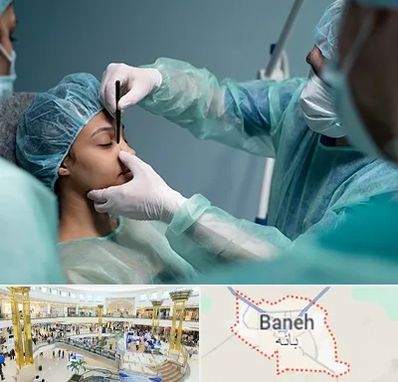 عمل بینی ارزان در بانه