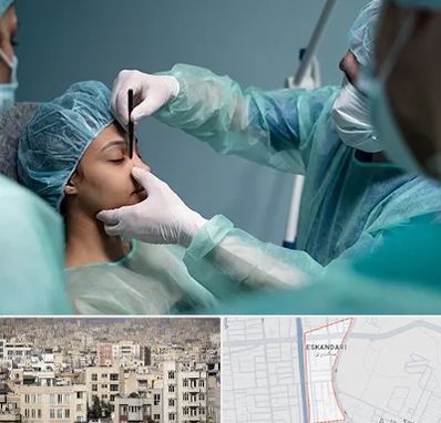 عمل بینی ارزان در اسکندری