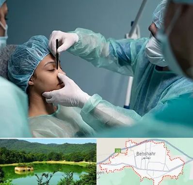 عمل بینی ارزان در بهشهر