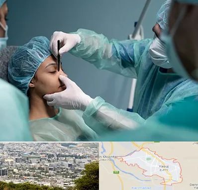 عمل بینی ارزان در یاسوج
