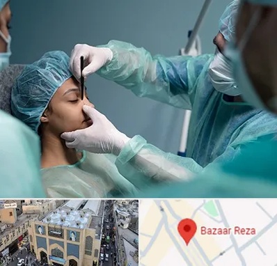 عمل بینی ارزان در بازار رضا مشهد