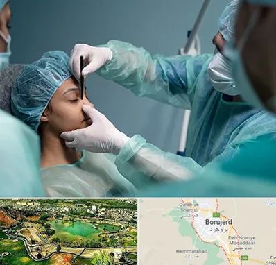 عمل بینی ارزان در بروجرد