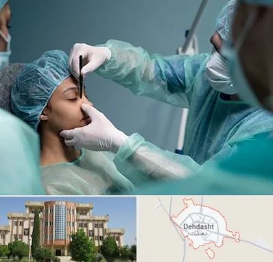 عمل بینی ارزان در دهدشت