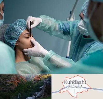 عمل بینی ارزان در کوهدشت