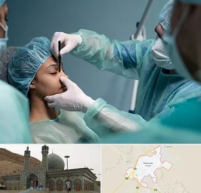 عمل بینی ارزان در شهرضا