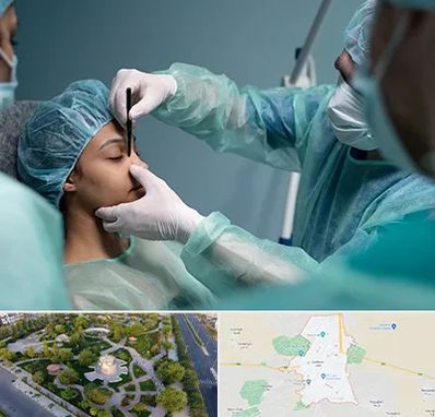 عمل بینی ارزان در کاشمر