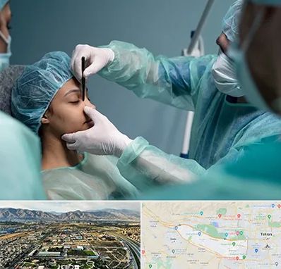 عمل بینی ارزان در منطقه 21 تهران 