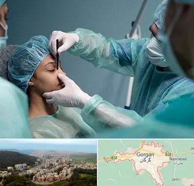 عمل بینی ارزان در گرگان