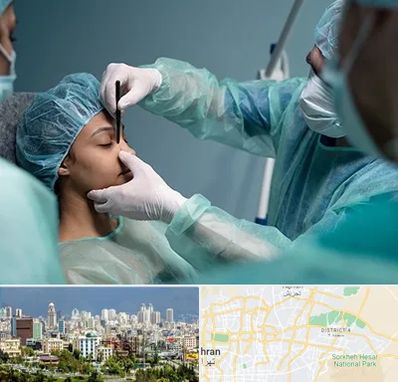 عمل بینی ارزان در شرق تهران 