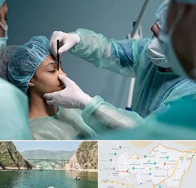 عمل بینی ارزان در ایلام