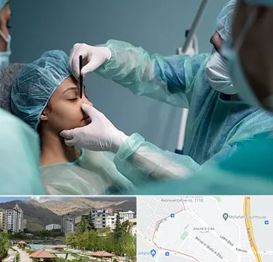 عمل بینی ارزان در شهر زیبا