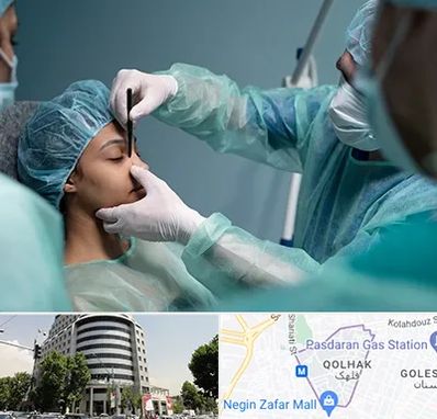 عمل بینی ارزان در قلهک 