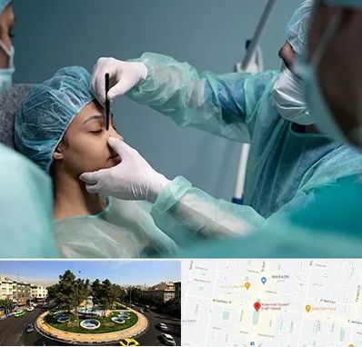 عمل بینی ارزان در هفت حوض