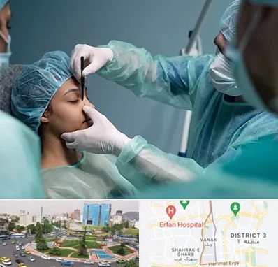 عمل بینی ارزان در ونک