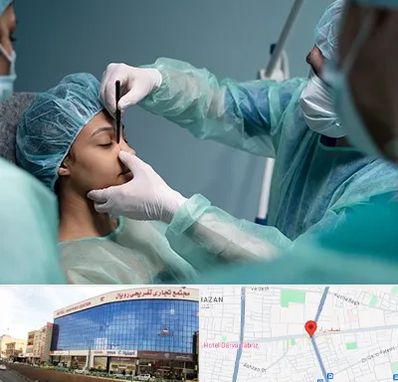 عمل بینی ارزان در نصف راه تبریز