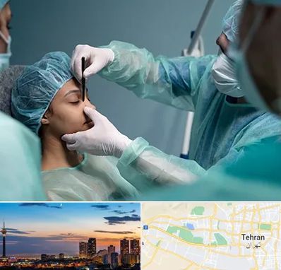 عمل بینی ارزان در غرب تهران 