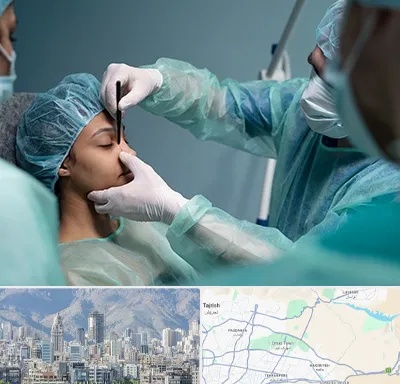 عمل بینی ارزان در شمال شرق تهران