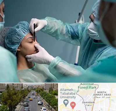 عمل بینی ارزان در شهران