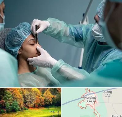 عمل بینی ارزان در کردکوی