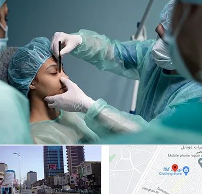 عمل بینی ارزان در چهارراه طالقانی کرج 