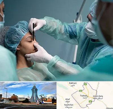 عمل بینی ارزان در تایباد