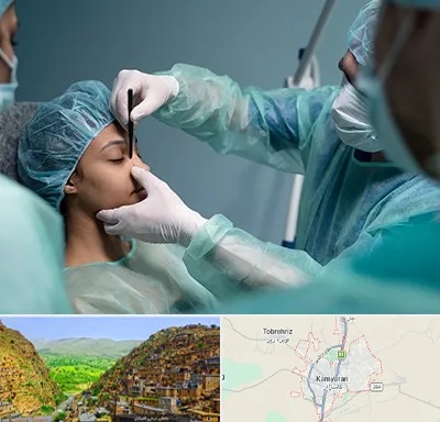 عمل بینی ارزان در کامیاران