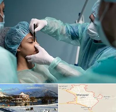 عمل بینی ارزان در ملایر