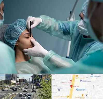 عمل بینی ارزان در ستاری 