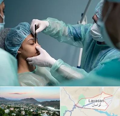 عمل بینی ارزان در لواسان