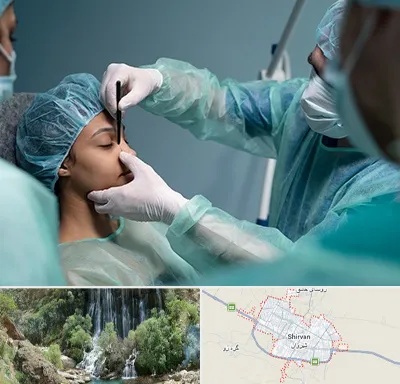 عمل بینی ارزان در شیروان