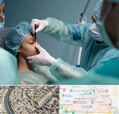 عمل بینی ارزان در شهرک غرب مشهد 