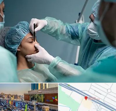 عمل بینی ارزان در لاله پارک تبریز