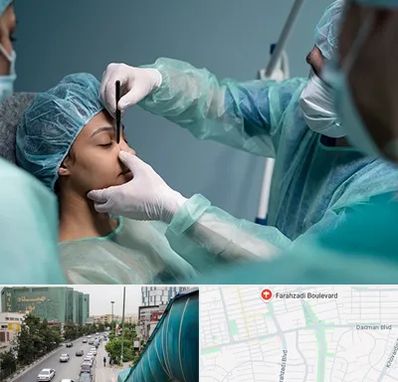 عمل بینی ارزان در بلوار فرحزادی