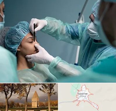 عمل بینی ارزان در تویسرکان