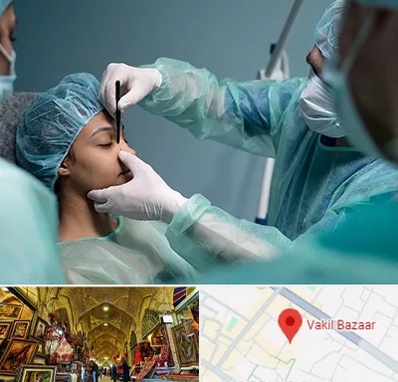 عمل بینی ارزان در بازار وکیل شیراز