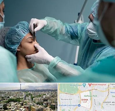 عمل بینی ارزان در گیشا 