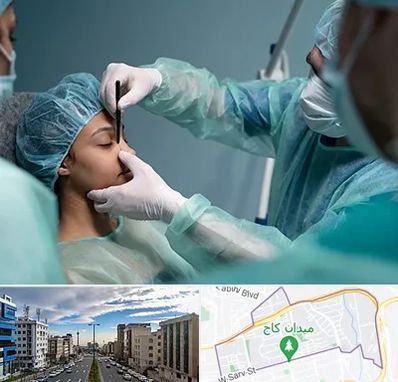 عمل بینی ارزان در سعادت آباد 