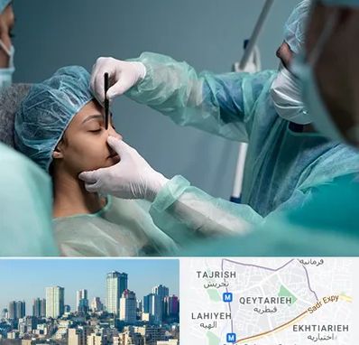 عمل بینی ارزان در قیطریه 