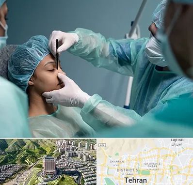 عمل بینی ارزان در شمال تهران 