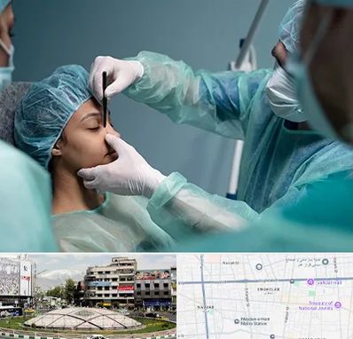 عمل بینی ارزان در مرکز تهران