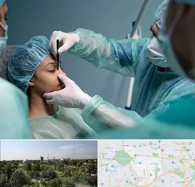 عمل بینی ارزان در منطقه 16 تهران 