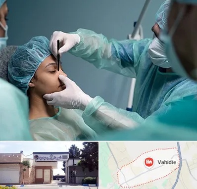 عمل بینی ارزان در وحیدیه شهریار