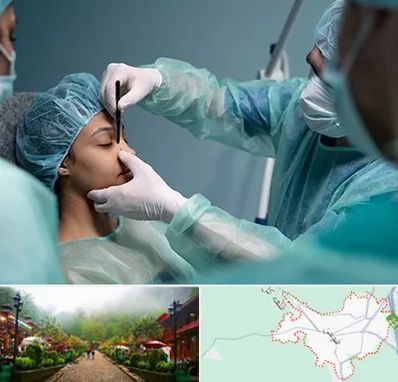 عمل بینی ارزان در فومن