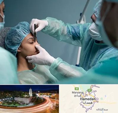 عمل بینی ارزان در همدان