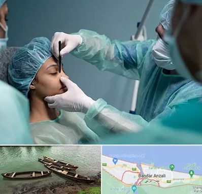 عمل بینی ارزان در بندر انزلی
