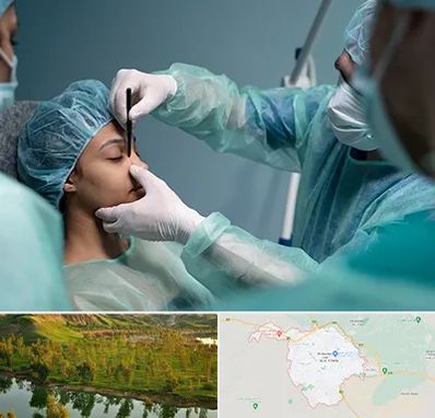 عمل بینی ارزان در بهبهان